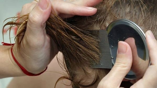 ฝันเห็นเหาเต็มหัว เลขเด็ด-lekruaythai