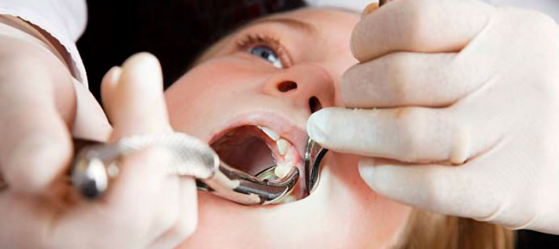 ฝันว่าฟันผุแล้วดึงออก-''Dreaming about having a tooth decay and pulling it out''