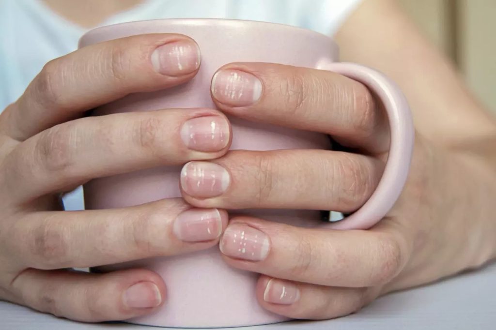 ฝันว่าเล็บนิ้วหลุด-"Dream of seeing your own fingernails"