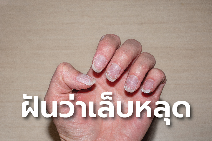 ฝันว่าเล็บนิ้วหลุด-"Dreaming that your fingernails fall off, lucky number."