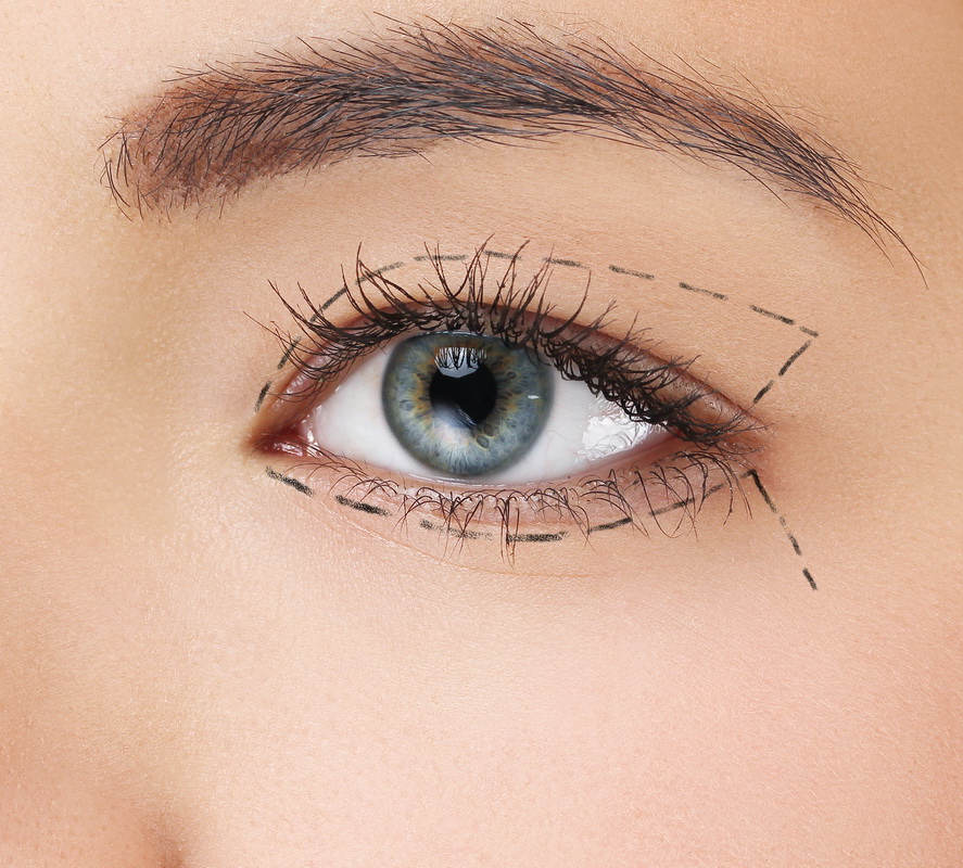 ฝันว่าศัลยกรรมตา - "Dream about eye surgery"