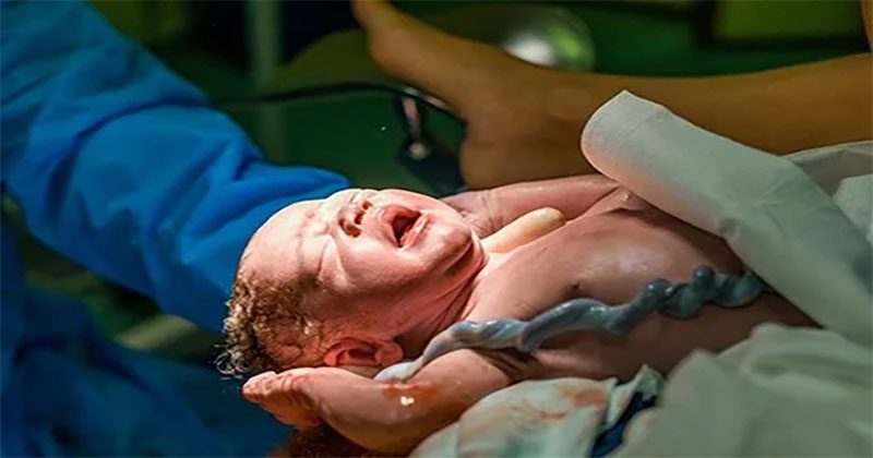 ฝันว่าคลอดลูกชายน่ารัก-"Dreamed of giving birth to a cute-son"