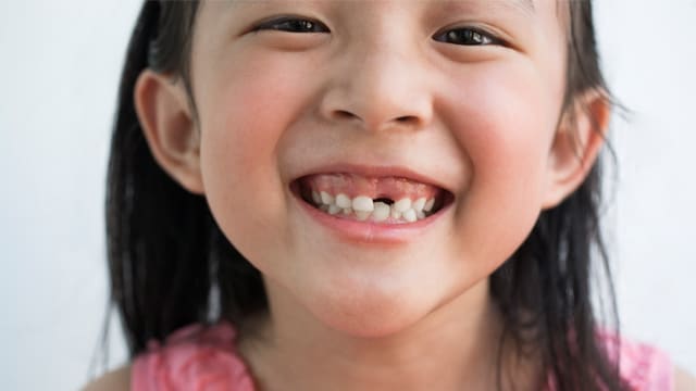 ฝันว่าแปรงฟันแล้วฟันหลุด-"Dreaming about brushing your teeth and your teeth fall out."