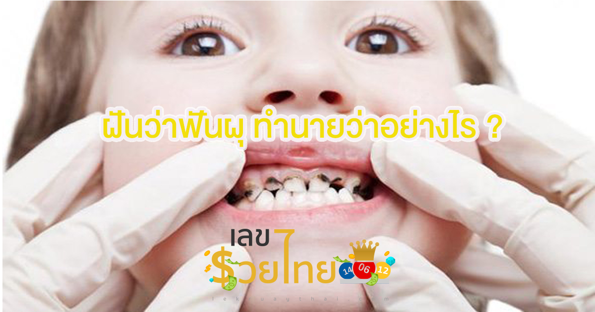 ฝันว่าฟันผุ ทำนายว่าอย่างไร? พร้อมตีเลขเด็ด ตามความฝัน ดูคำทำนาย แม่น ๆ ได้ที่นี่ lekruaythai