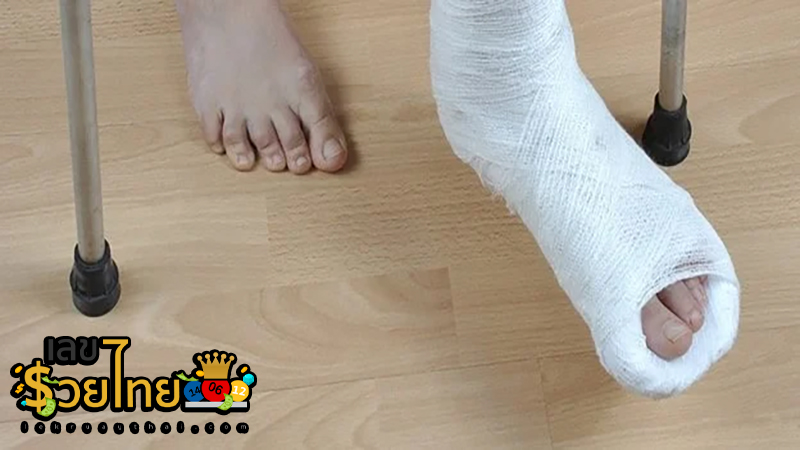 ฝันว่าขาหัก-"Dreamed that your leg was broken"