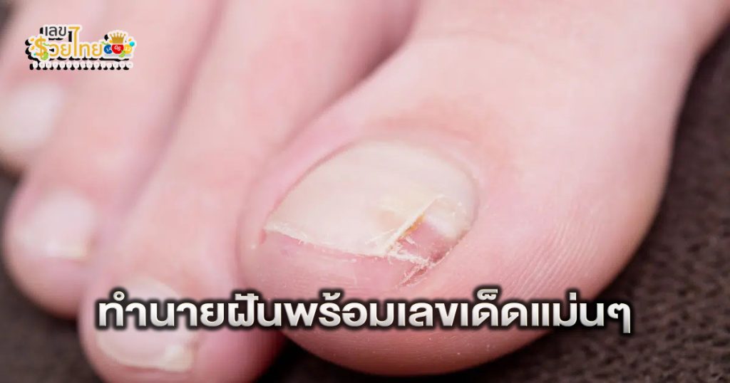 ฝันว่าสีเล็บหลุดลอก - "I dreamed that my nail polish was peeling off."